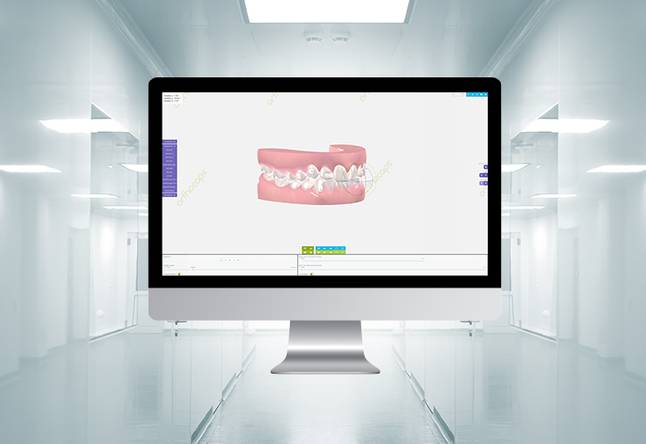 Ortho Caps 3D-Behandlungs-Simulations-Software Ortho Caps 3D-Behandlungs-Simulations-Software